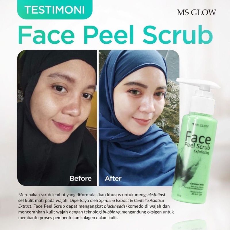 MS GLOW FACE PEEL SCRUB / SCRUB WAJAH / FACE SCRUB ORIGINAL PERAWATAN WAJAH BISA COD