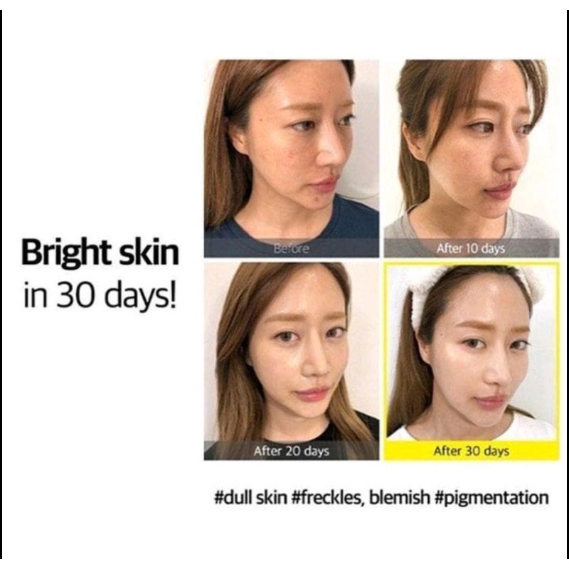 SomeByMi - Yuja Niacin 30 days Starter Kit - Some By Mi