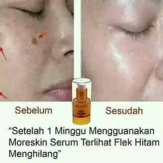 Serum gold nasa