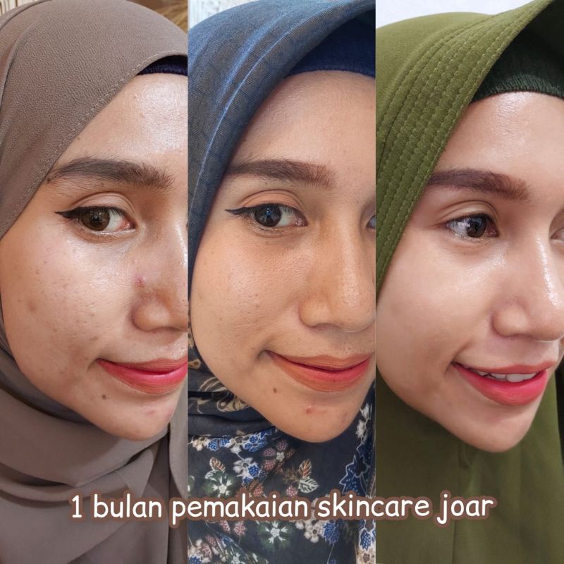 Joar skincare banda aceh bisa cod dapat gift