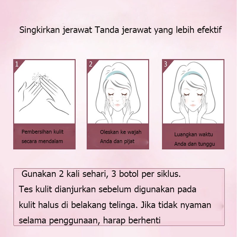 krim penghilang melasma Krim Pemutih Wajah Krim Penghilang Bintik Hitam 30g meringankan melasma dan bintik-bintik Mencerahkan kulit Mengurangi kulit kusam