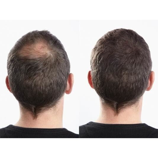 Super Sale! PROMO Bunee Hair Building Fiber 27.5 G Fungsi 100 Sama Dengan Caboki