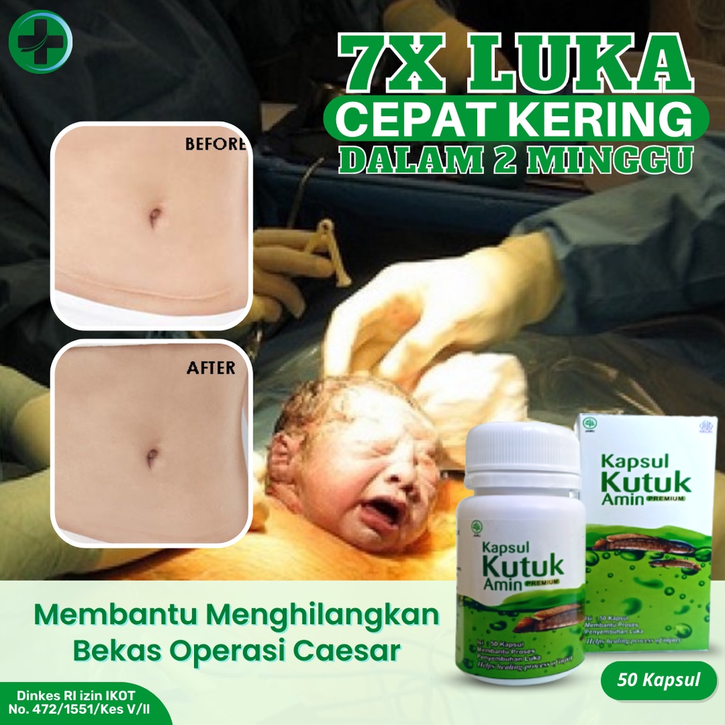 Kapsul Kutuk Pro Albumin Kapsul Gabus Original - Kapsul Ikan Gabus Pasca Operasi - Kapsul Kutuk Prem