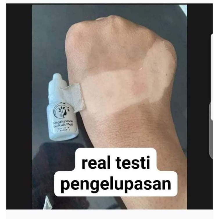 peeling badan pengelupasan