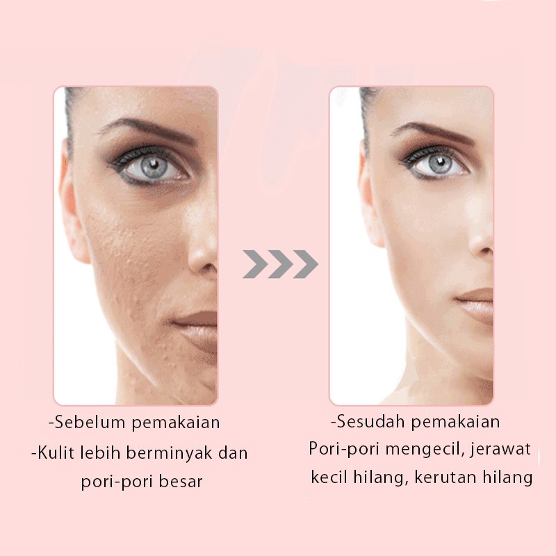 E ONE alat setrika wajah glowing ion 4in1 / setrika wajah penghilang kerutan / alat pijat wajah / alat pengencang wajah