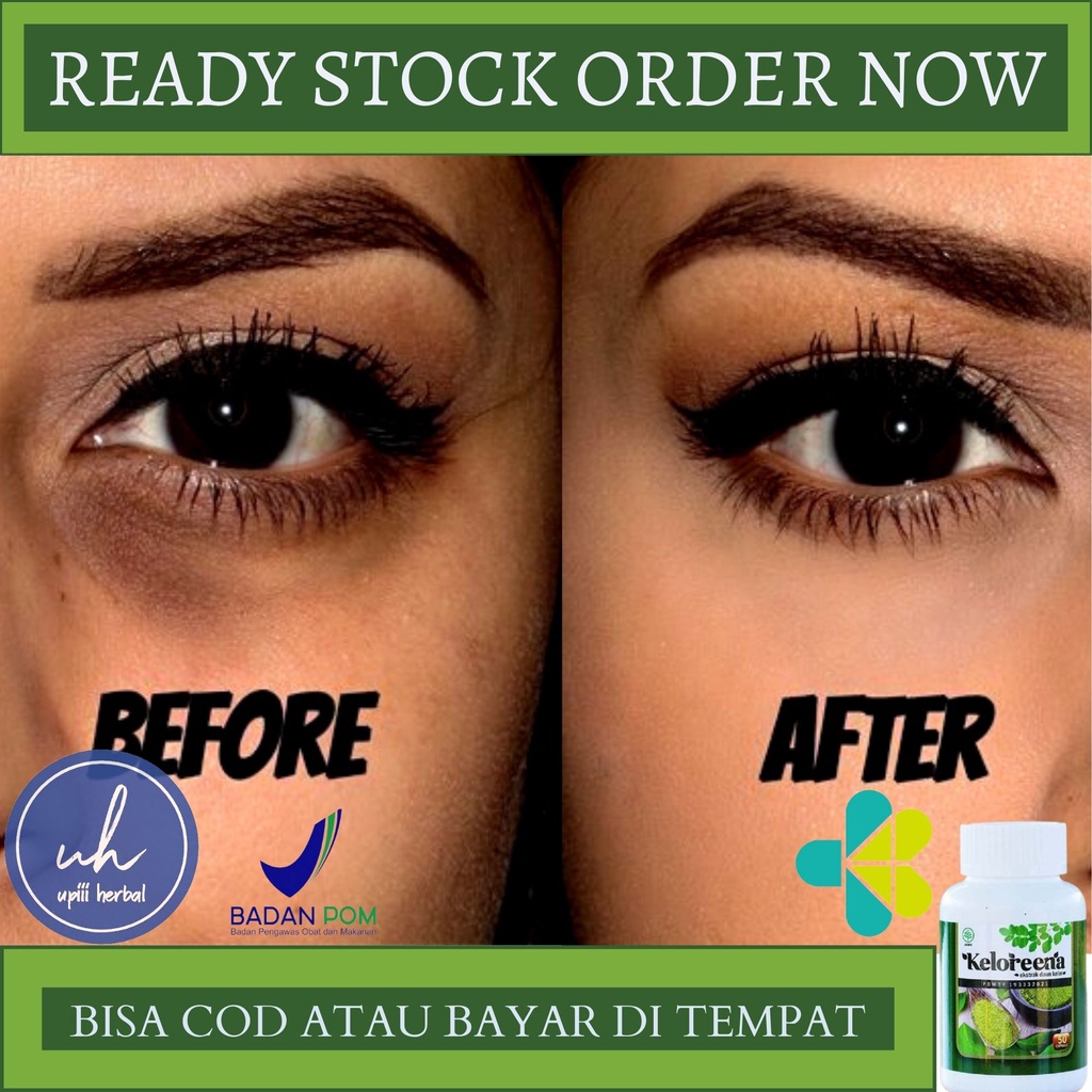 Obat Mata Hitam, Obat Penghilang Mata Hitam, Obat Kelopak Mata Hitam, Obat Mata Panda, Obat Pemudar 