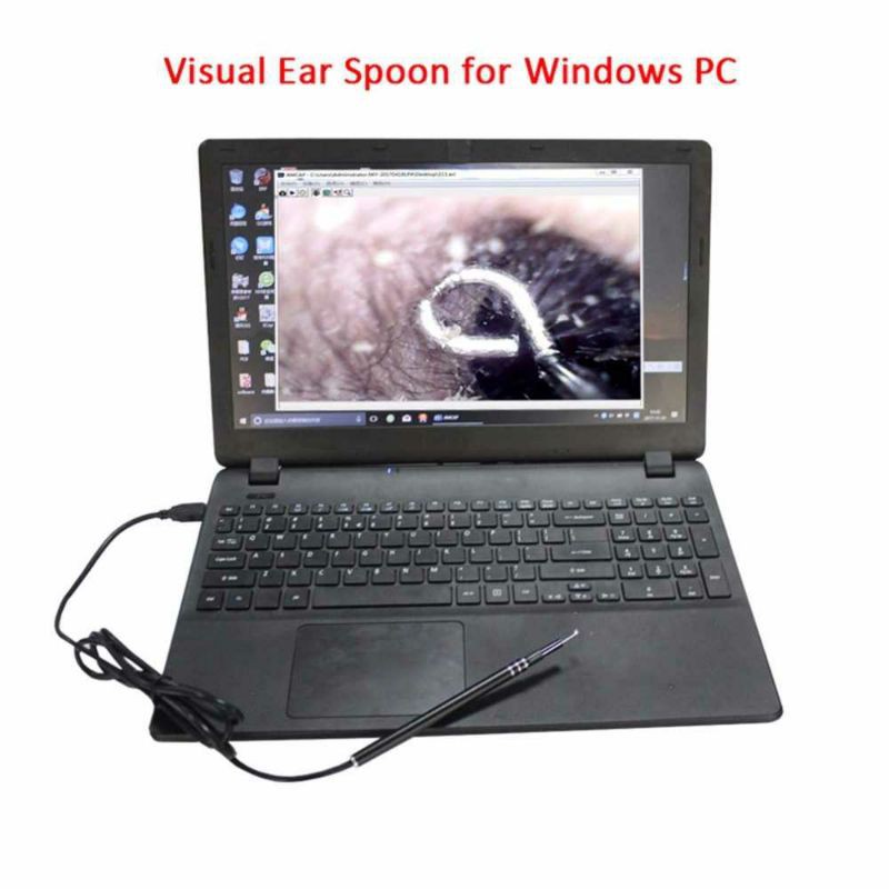 Kamera Korek Kuping Camera Endoscope HD Visual Earpick