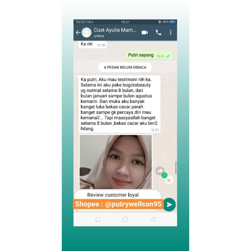 BOGOTA SKINCARE Normal /Acne Series / cream wajah / bogota beauty / skincare / penghilang jerawat-4