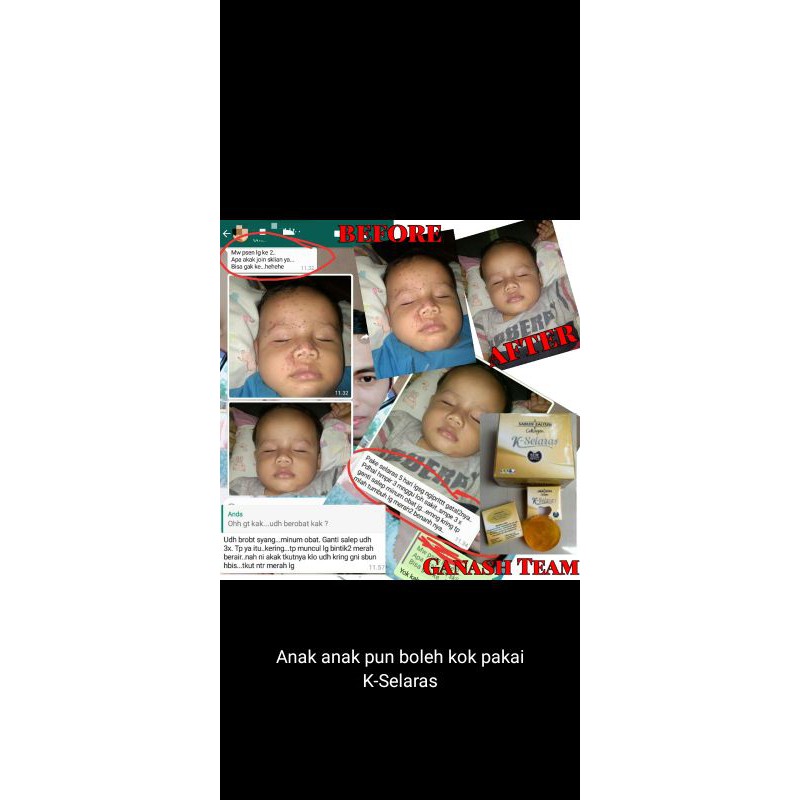 

sabun zaitun collagen