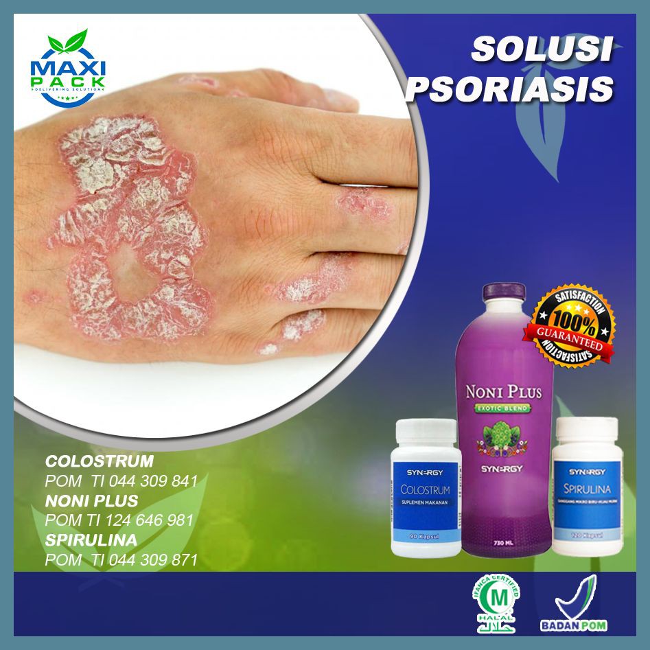 Obat Herbal Kulit Mudah Terkelupas Psoriasis Maxipack Herbal