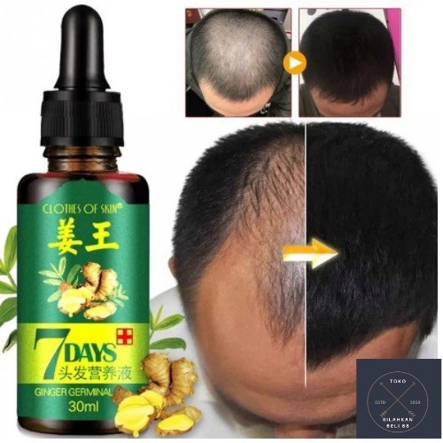 HM-BE KING OF GINGER HAIR SERUM / SERUM GINGER PENUMBUH RAMBUT
