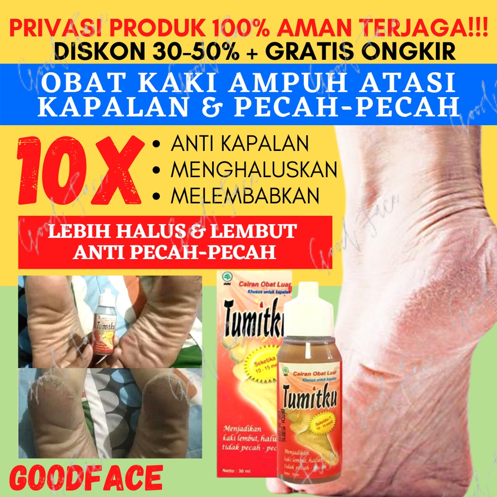 TUMITKU 30ML - TUMITKU OBAT HERBAL PENGHALUS TUMIT 30ML ORIGINAL BPOM