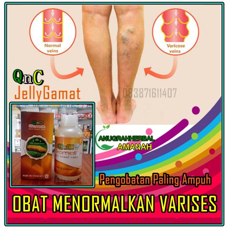 Obat Varises Ampuh Varikokel Asam Urat Rematik Sakit Sendi Memperlancar Darah Qnc Jelly Gamat Shopee Indonesia