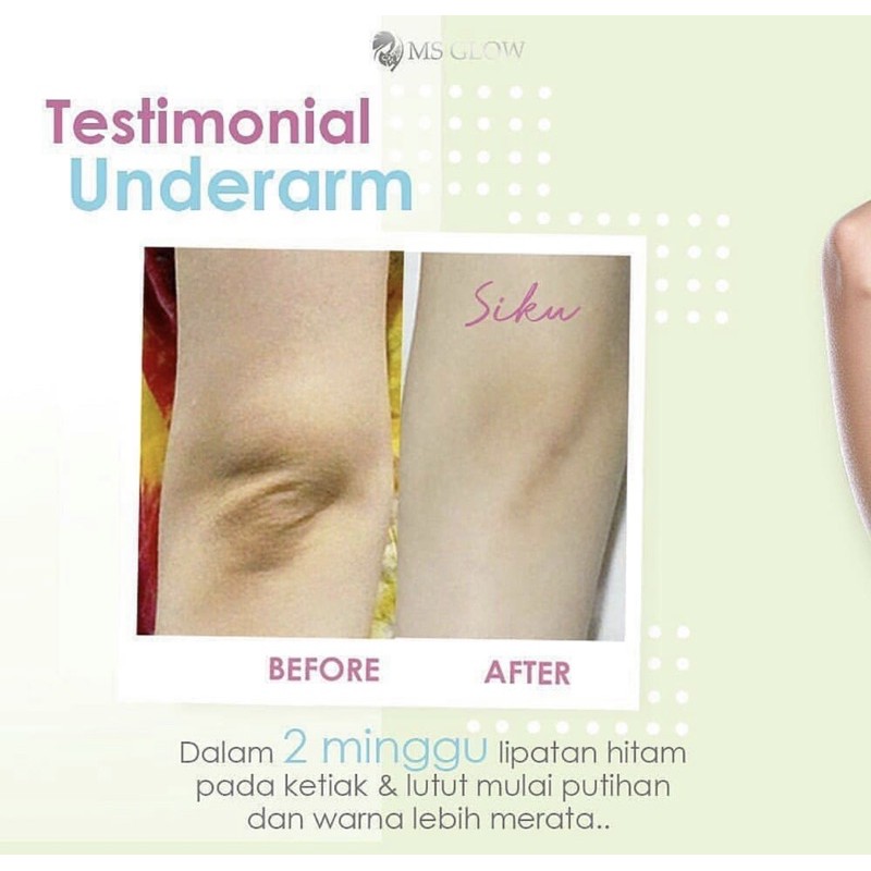 UNDERARM - PEMUTIH KETIAK - MS GLOW