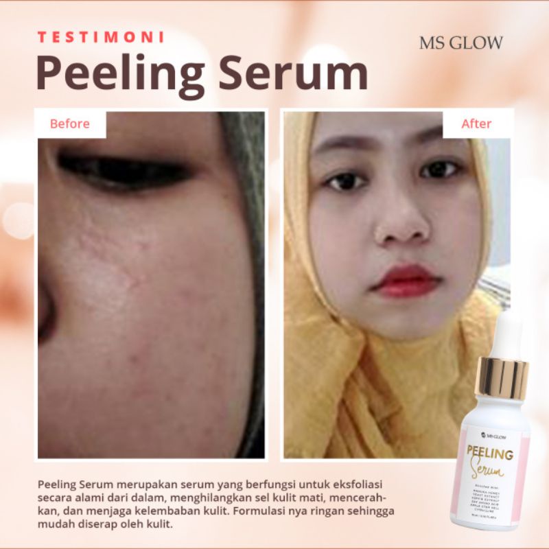 Ms Glow Serum Peling Original100% Ms Glow Exfoliating Serum Serum Eksfoliasi Peeling Serum