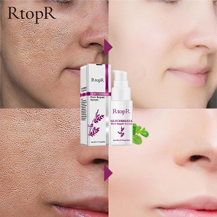 RtopR GLYCYRRHIZA Pore Repair Serum  Perbaikan Pori-pori Wajah Pengontrol Minyak Hidrasi Efektif Mengecilkan Pori-pori