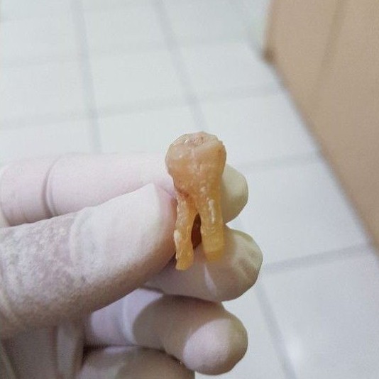 GIGI ASLI MANUSIA MOLAR GERAHAM UNTUK PRAKTIKUM