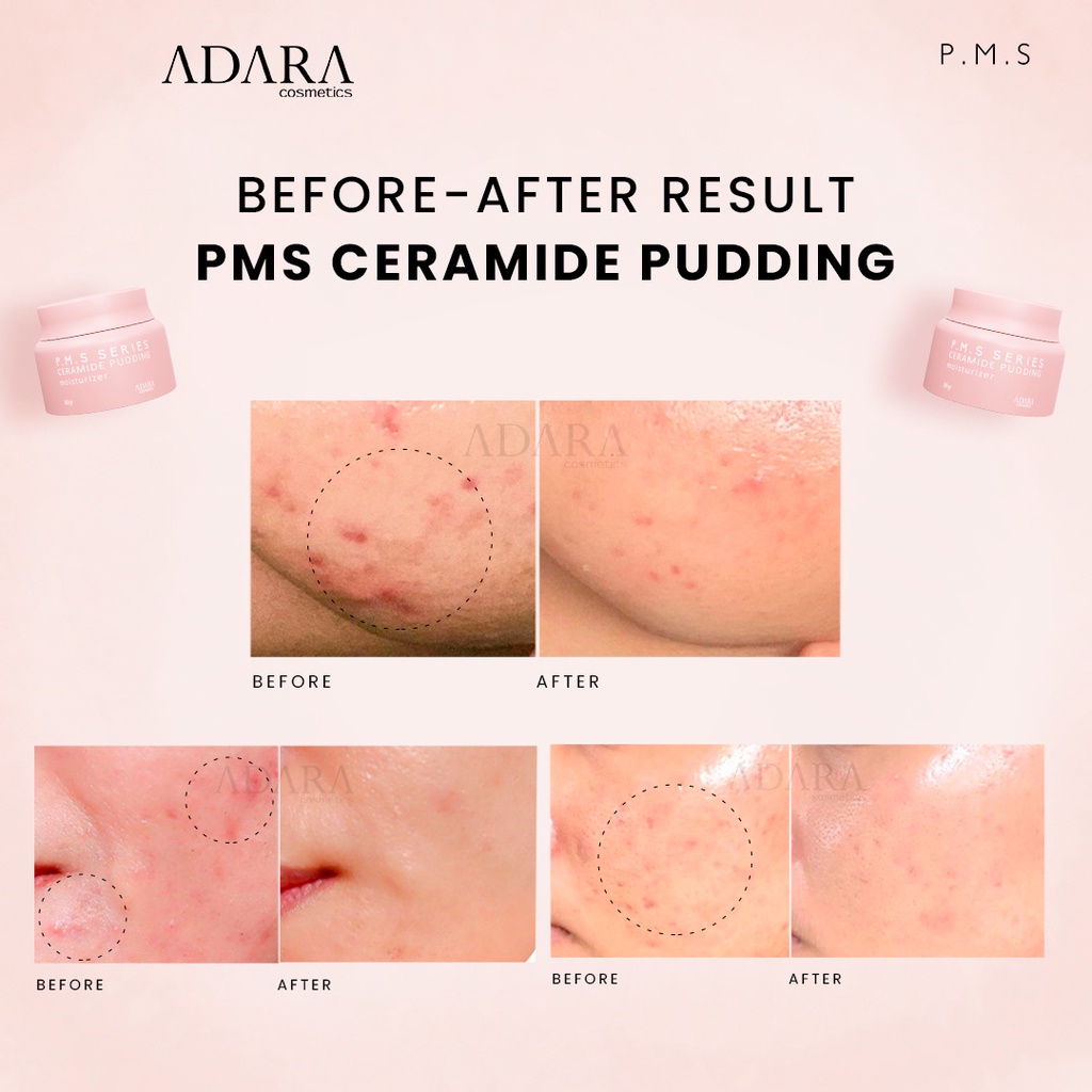 ADARA P.M.S Series Ceramide Pudding 30gr