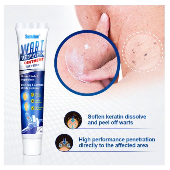 Wart Removal Cream Repair And Clean Skin Tag Remover 20g - Menghilangkan Kutil Tahi Lalat Mata Ikan Sumifun Obat Kutil