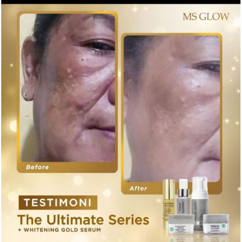 Paket Ultimate+Serum Gold whitening glowing MS GLOW