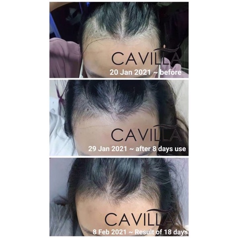 CAVILLA HAIR TONIC PENUMBUH RAMBUT CEPAT ALAMI (100% ORIGINAL)
