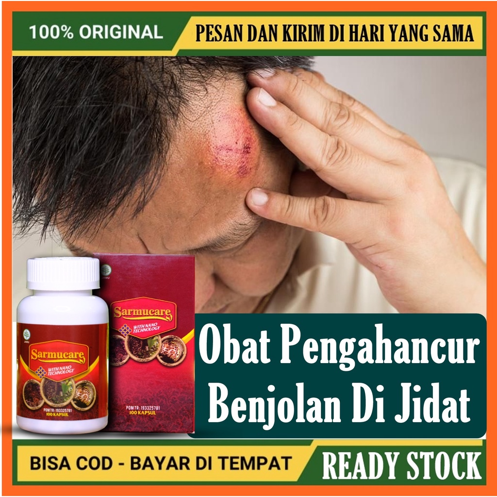 Obat Benjolan Di Jidat - Benjolan Di Kening - Benjolan Lipoma - Penghancur Benjolan Di Jidat Pada An
