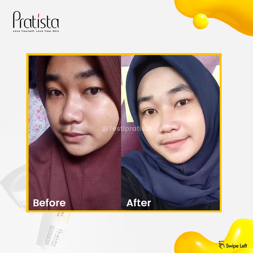 PRATISTA CALMING SPRAY CICA HYDRATING MIST FACE SPRAY HYALU TONER FACE SPRAY FACE MIST CALMING CICA SPRAY PRATISTA TONER 100ML | RETINOL RENEWAL SERUM 10ML 30ML BY PRATISTA SKINCARE SERUM RETINOL CALMING SPRAY PRATISTA.ID SERUM JERAWAT RETINOL VIRAL