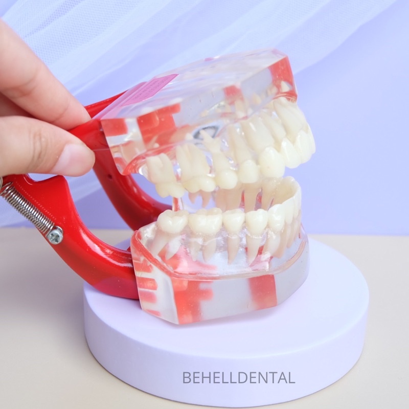 DENTAL STUDY MODEL GIGI TRANSPARAN - Patung Pantom Belajar Dental Ortho - Tidak Bisa Di Lepas Pasang - Model Gigi Mahasiswa Dokter Clear - Behelldental