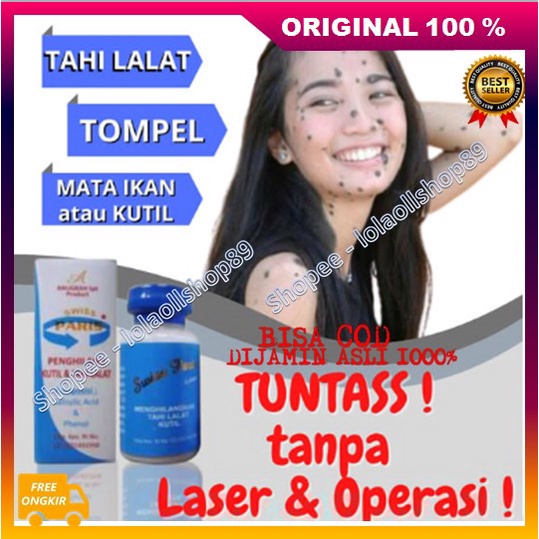 [BISA COD] BELI 2 GRATIS 1 Salep Kutilang Salep Tahi Lalat, Kutil & Daging Tumbuh Ampuh 100% ORIGINA