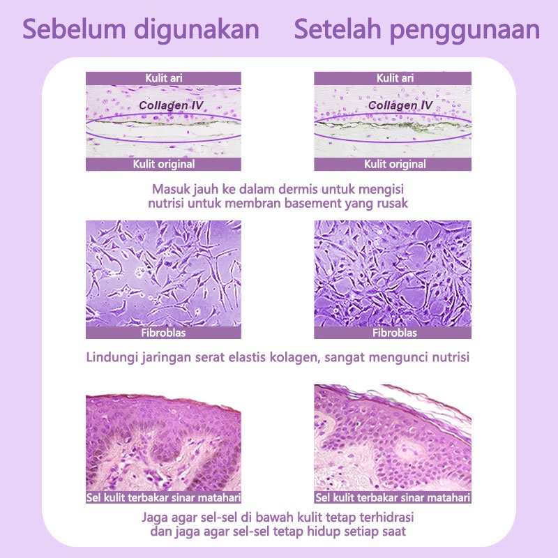 AmazeFan Alat Setrika Esensi Pemutih Alat Impor Serum Anti Penuaan Pemijat Wajah Serum Facial Pelangsing Wajah Lifting Massager Perbaikan Jerawat Mesin Rf