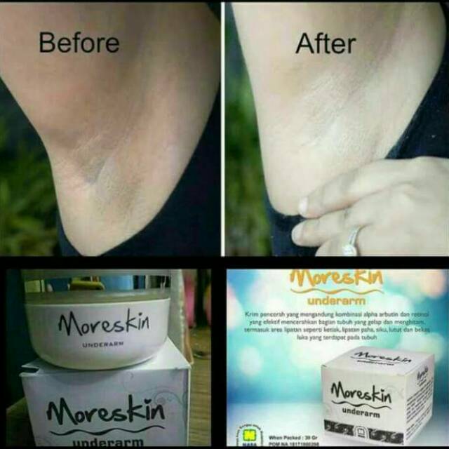 Moreskin underarm
