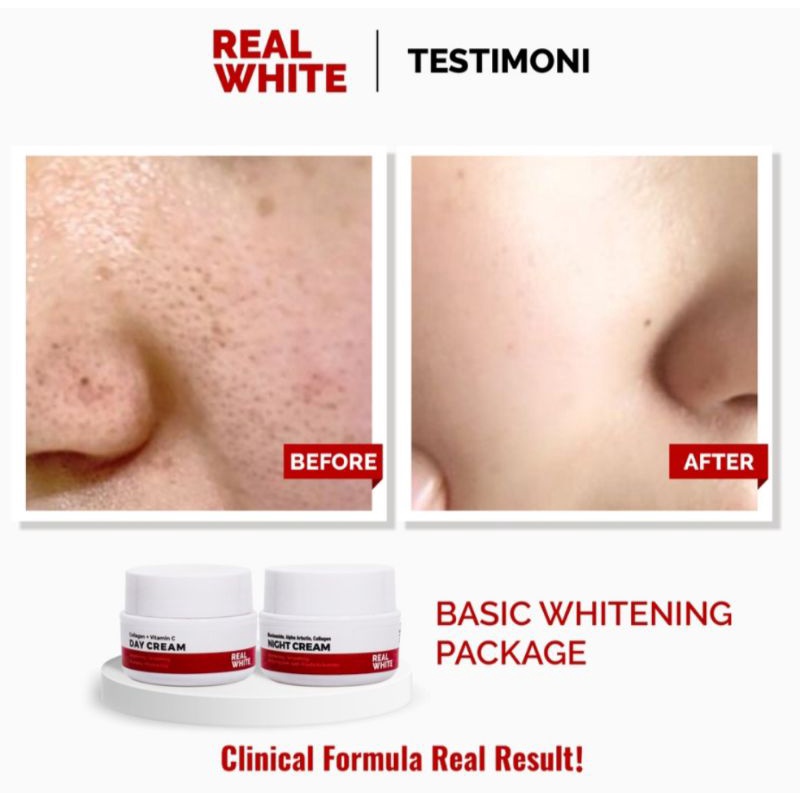 Real white day cream/night cream 10gr