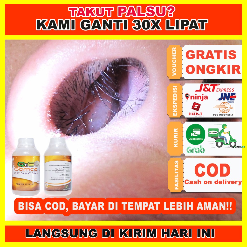 QNC JELLY GAMAT/ Obat Polip Hidung Anak Dewasa/ Obat Penghilang Polip/ Obat Polip Herbal