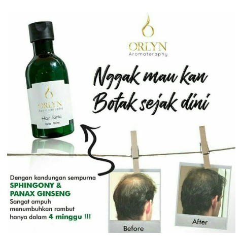 Obat Penumbuh Rambut Orlyn Aromateraphy Hair Tonic NASA