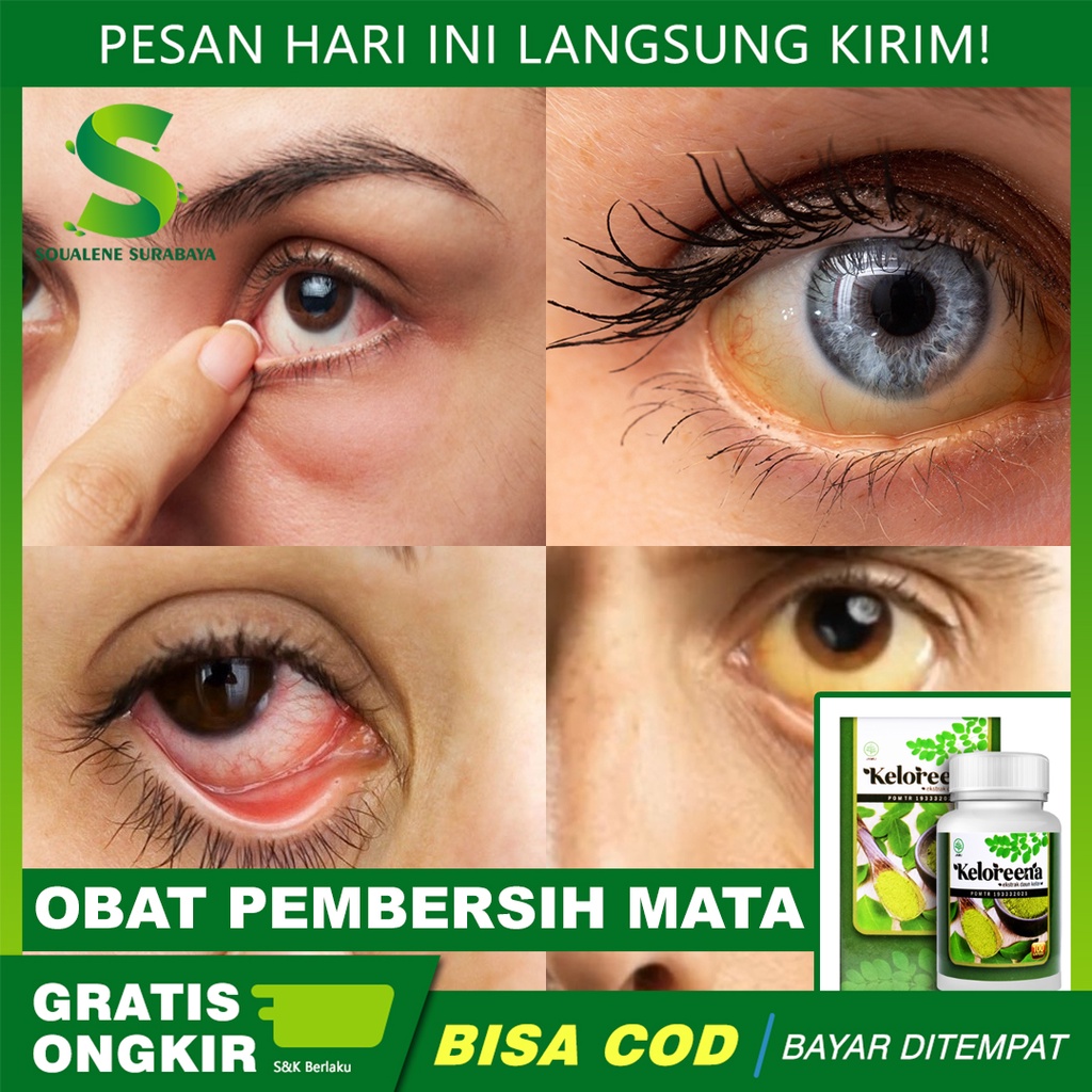 Obat Pembersih Mata - Obat Mata Berlemak - Mata Rabun - Obat Mata Floaters - Keloreena Ekstrak Daun 