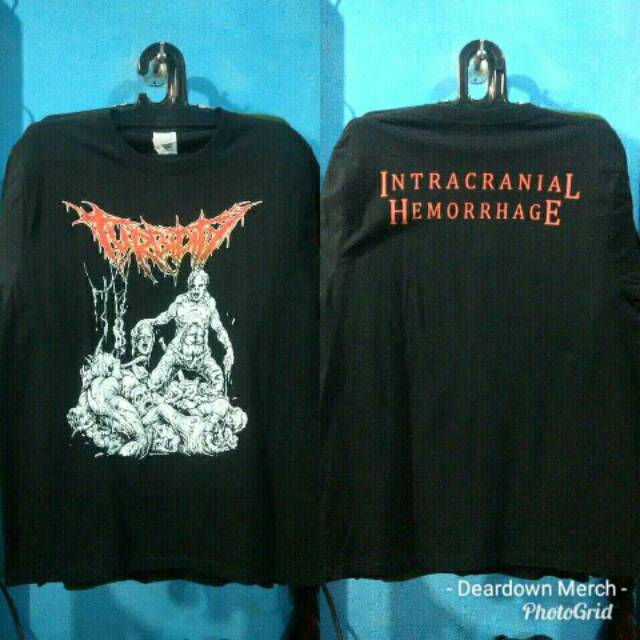 TS TURBIDITY - INTRACRANIAL