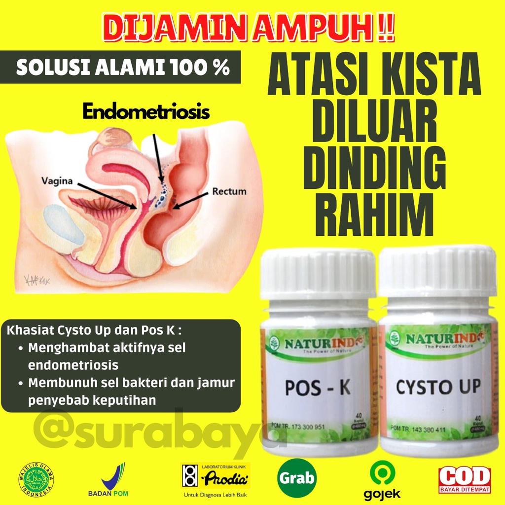 Obat Kista dan Miom Ovarium Obat Herbal Kista Bartholin Obat Penyakit Rahim Obat Cista Cysta Obat Miom Myom Coklat Obat Kista Endometriosis Ampuh Jamu Herbal Kista Miom Tumor Mioma Ampuh BPOM HALAL MUI CYSTO UP Naturindo Surabaya 40 Kapsul-KISTA DI LUAR RAHIM