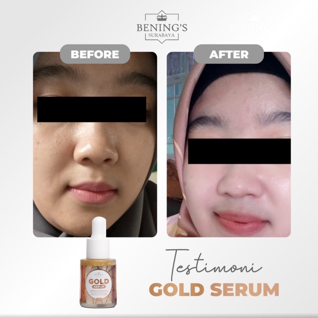 BENING'S SERUM GOLD | MENCERAHKAN, MELEMBABKAN &amp; MERATAKAN WARNA KULIT I FREE GIFT SIAP KIRIM KE SELURUH INDONESIA