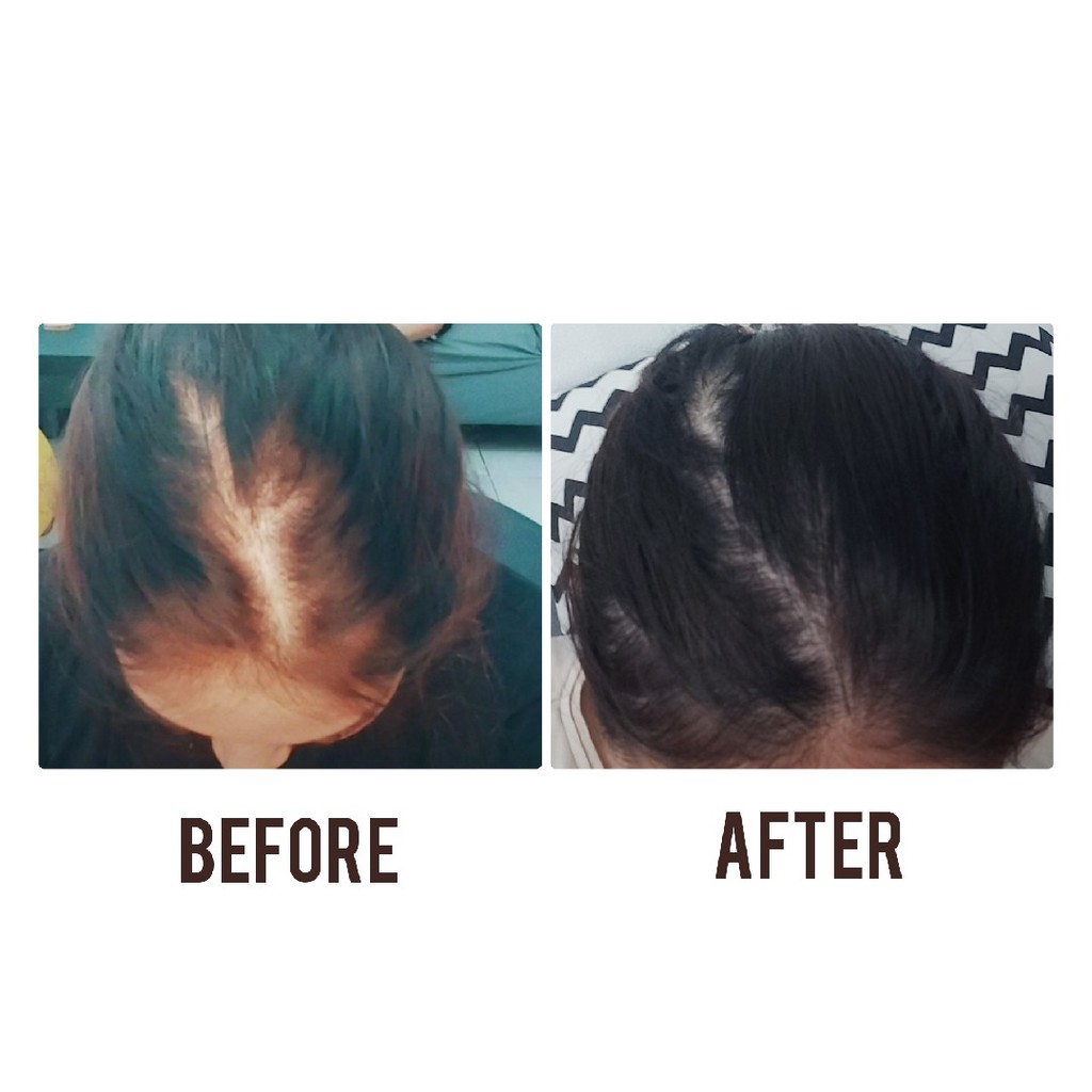 NR Hair Reactive Tonic 200 ml/NR Hair Tonic/MENGATASI KETOMBE DAN RAMBUT RONTOK-7