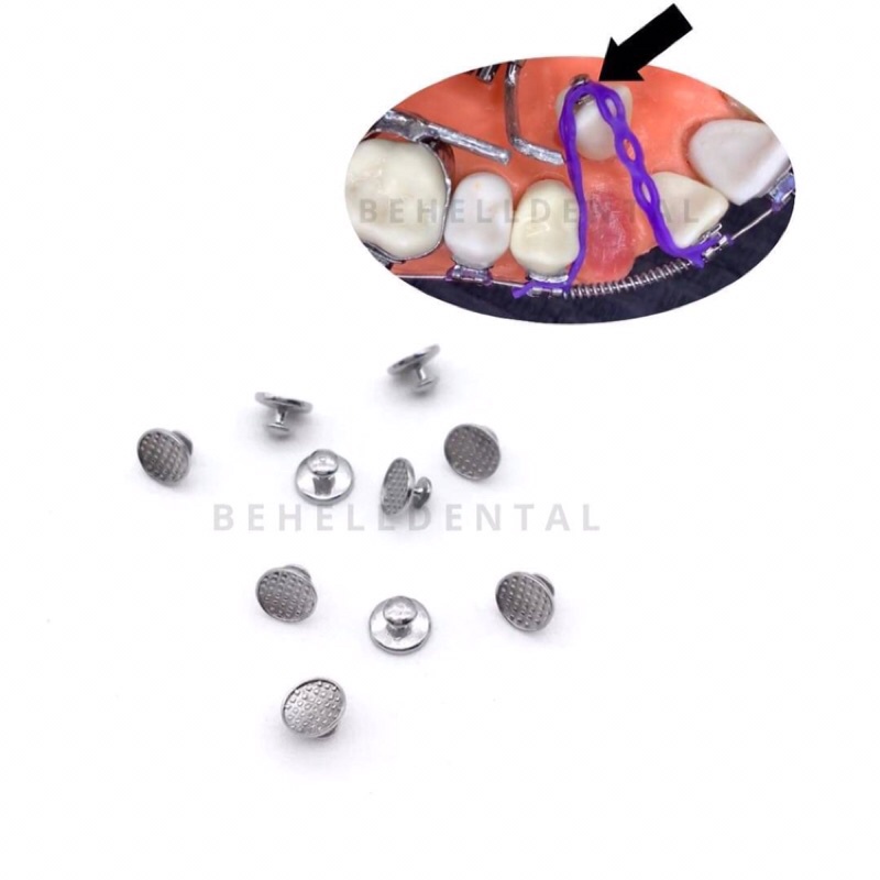 ORIGINAL LINGUAL BUTTON ISI 10 Round Bulat Bundar Bondable - Dental Lingual Buttons Behel Ortho Orthodontic Palatal Bracket Behelldental Braces