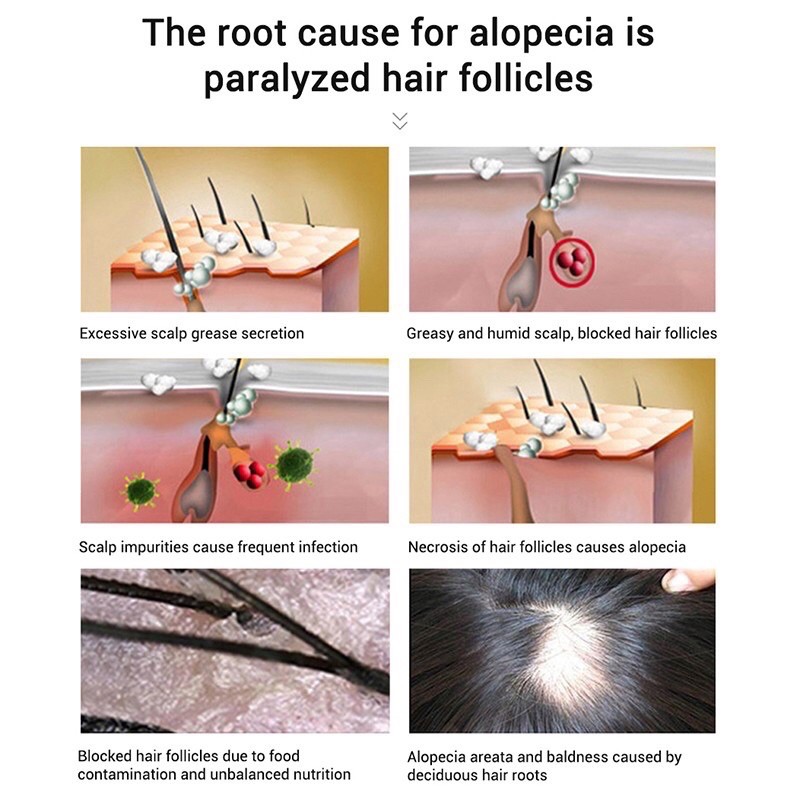 LANBENA serum penumbuh rambut herbal / lanbena hair growth serum