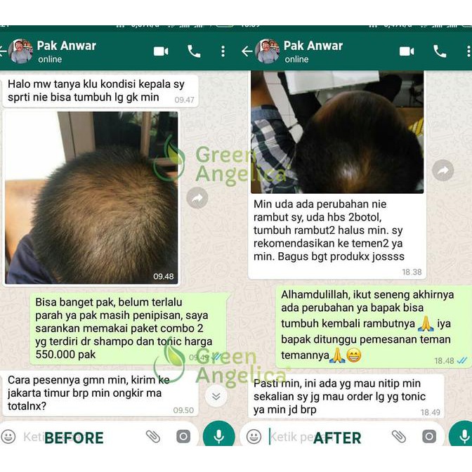 New Product Perawatan Rambut Paling Lengkap Green Angelica Paket Maximal Treatment Free Ongkir