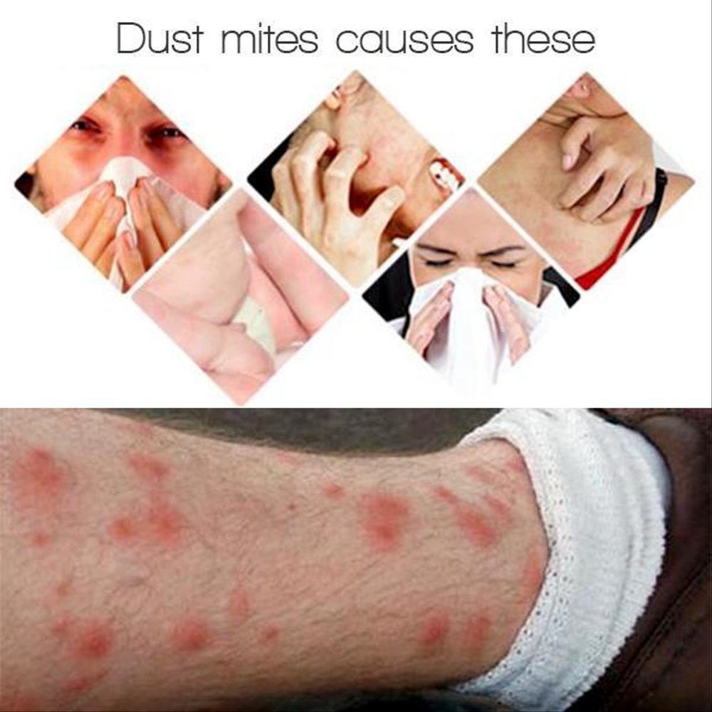 3pcs Dust Mite Killing Pad - Pembasmi Tungau Debu - Anti Kutu