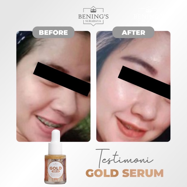 BENING'S SERUM GOLD | MENCERAHKAN, MELEMBABKAN &amp; MERATAKAN WARNA KULIT I FREE GIFT SIAP KIRIM KE SELURUH INDONESIA