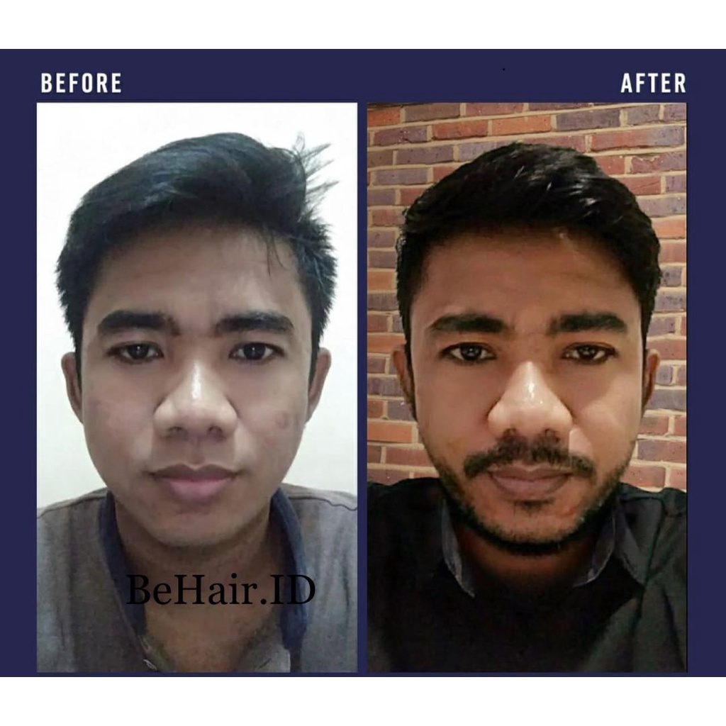 TERLARIS Serum Liquid BIOFINMIX BeHaird.ID BOURN BEARD Finmix Cave Biotin Finasteridee Minoxidil 5% BeHairId Penumbuh Jambang Kumis Alis Rambut Brewok Mencegah Kerontokan Kebotakan Uban ketombe ASLI ORIGINAL 100% Serum Beard OIL Penumbuh Brewok