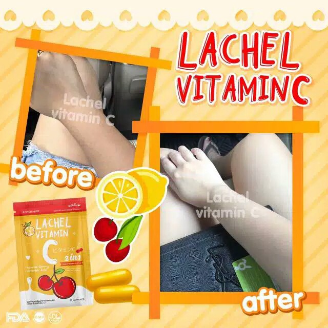 Lachel VITAMIN C ISI 60 KAPS