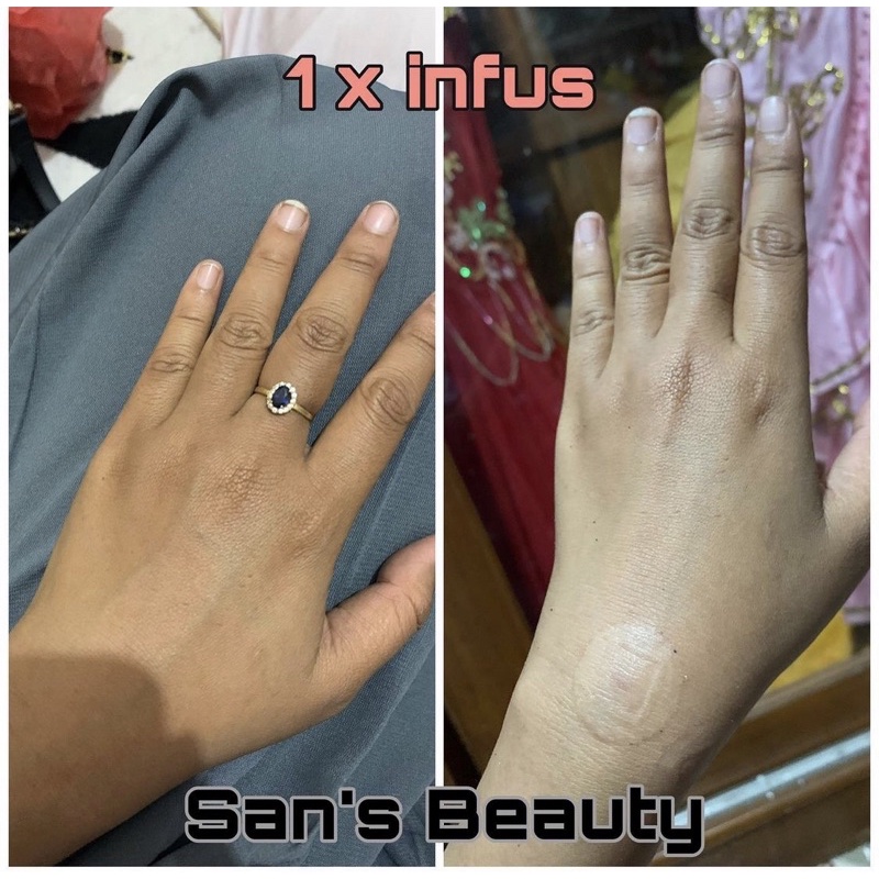 Infus Whitening Super kromosom