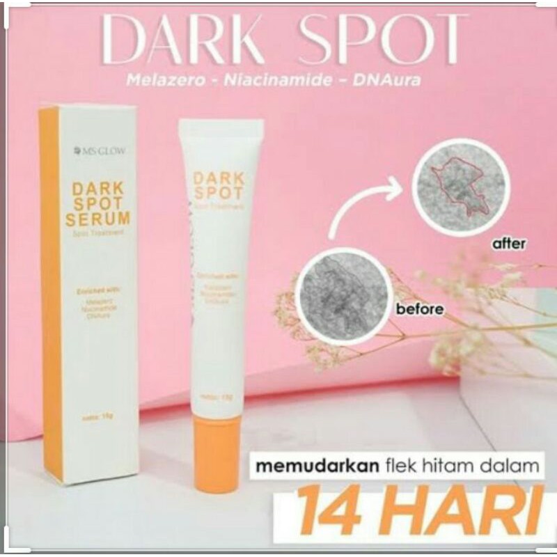 DARK SPOT TREATMENT MS GLOW/DARK SPOT MS GLOW/MS GLOW UNTUK FLEK HITAM/PENGHILANG FLEK HITAM