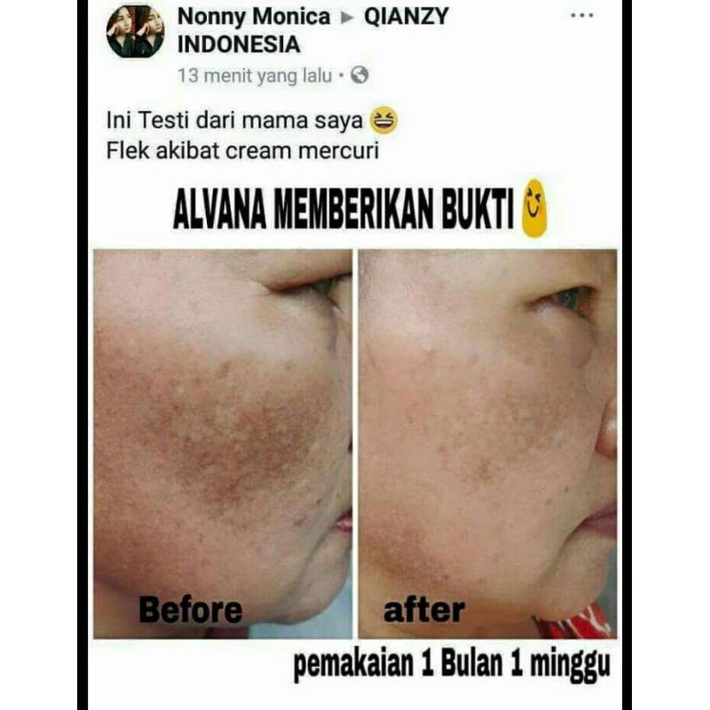 SABUN AJAIB ALVANA BLACK