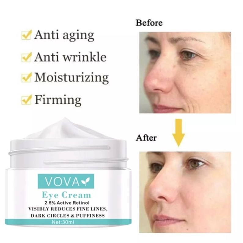 VOVA KRIM RETINOL 30ml-PENGHILANG INSTANT KANTUNG MATA KRIM PENGENCANG PENCERAH KULIT WAJAH MENGHILANGKAN KERIPUT PENUAAN